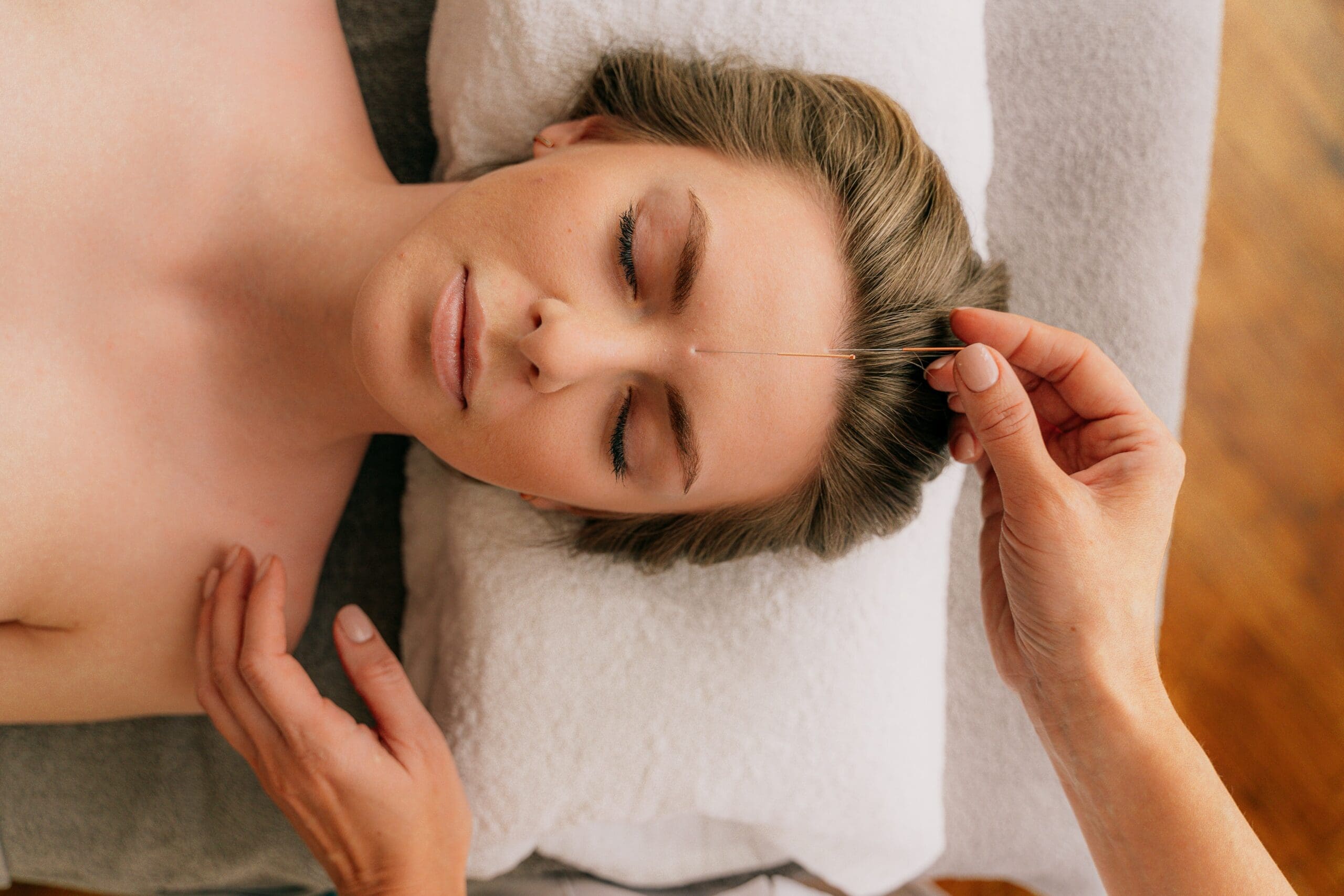 How Acupuncture Can Be Part of a Holistic Health Approach