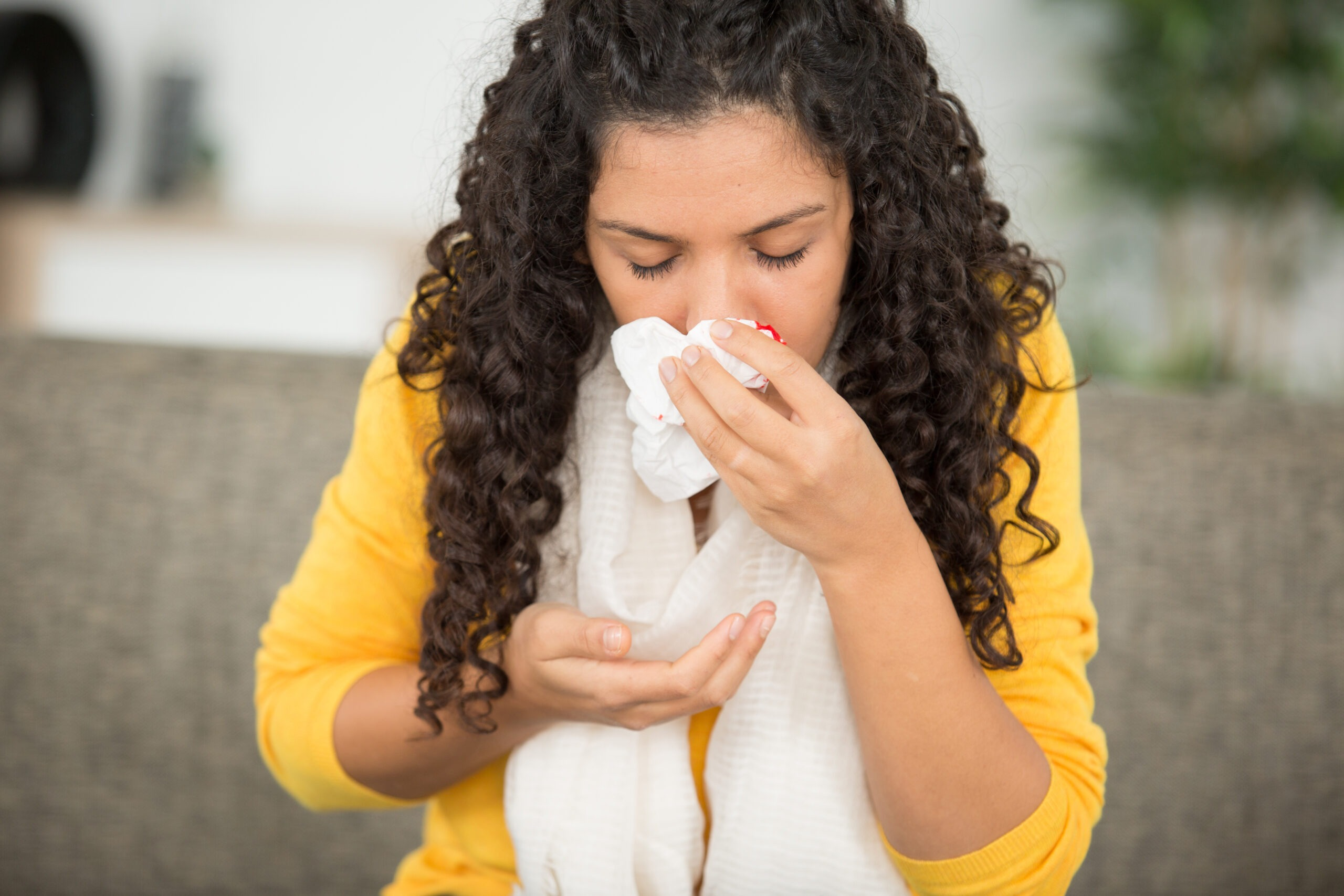 How to Stop Frequent Nosebleeds Naturally