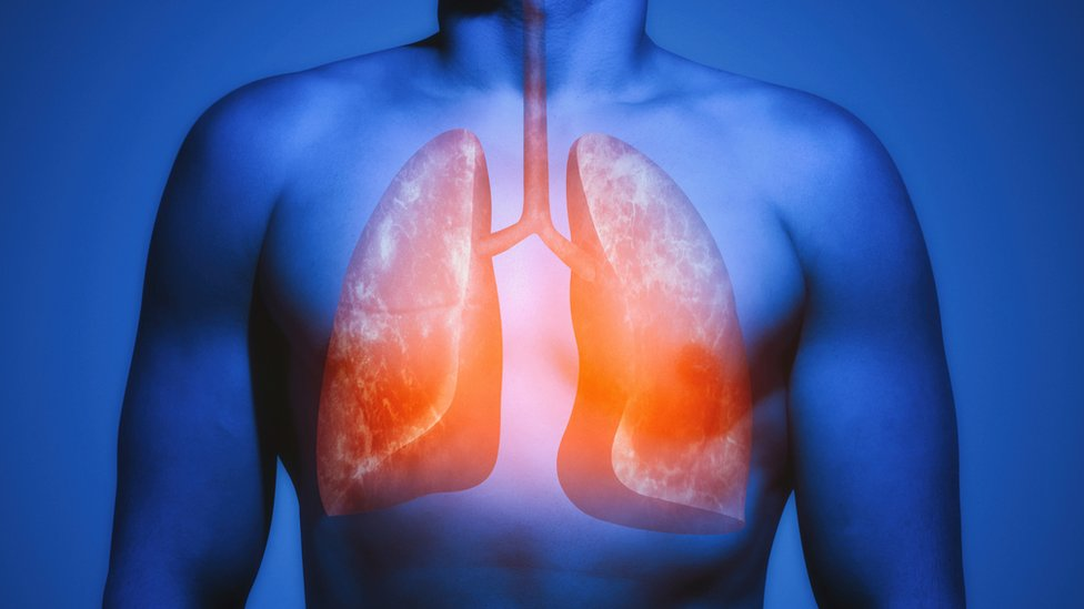 Natural Ways to Improve Lung Function After Quitting Smoking