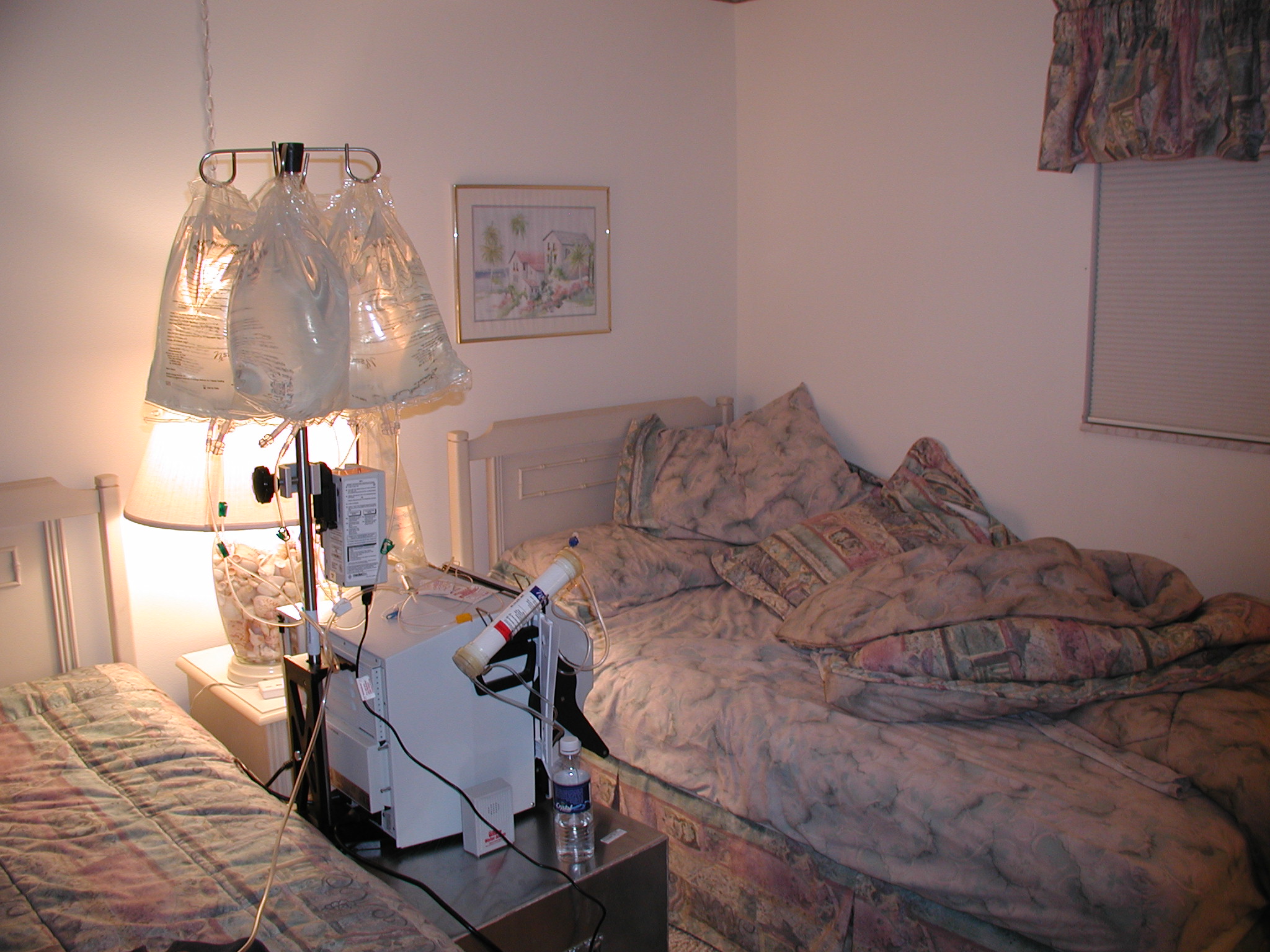 Dialysis Access: Why It’s Essential for People with Kidney Disease