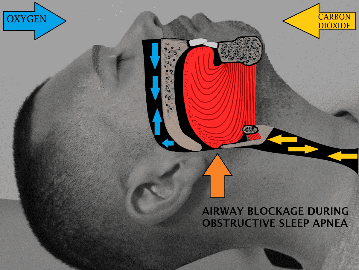 Signs You May Need to See a Snoring Specialist