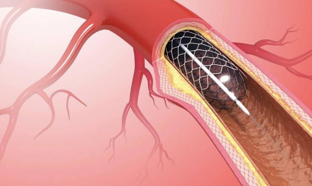 The Benefits of Choosing a Board Certified Cardiologist