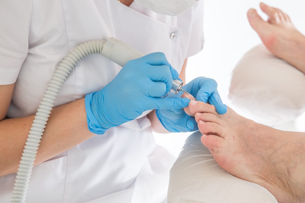 Tips for Maintaining Healthy Toenails and Preventing Fungal Infections