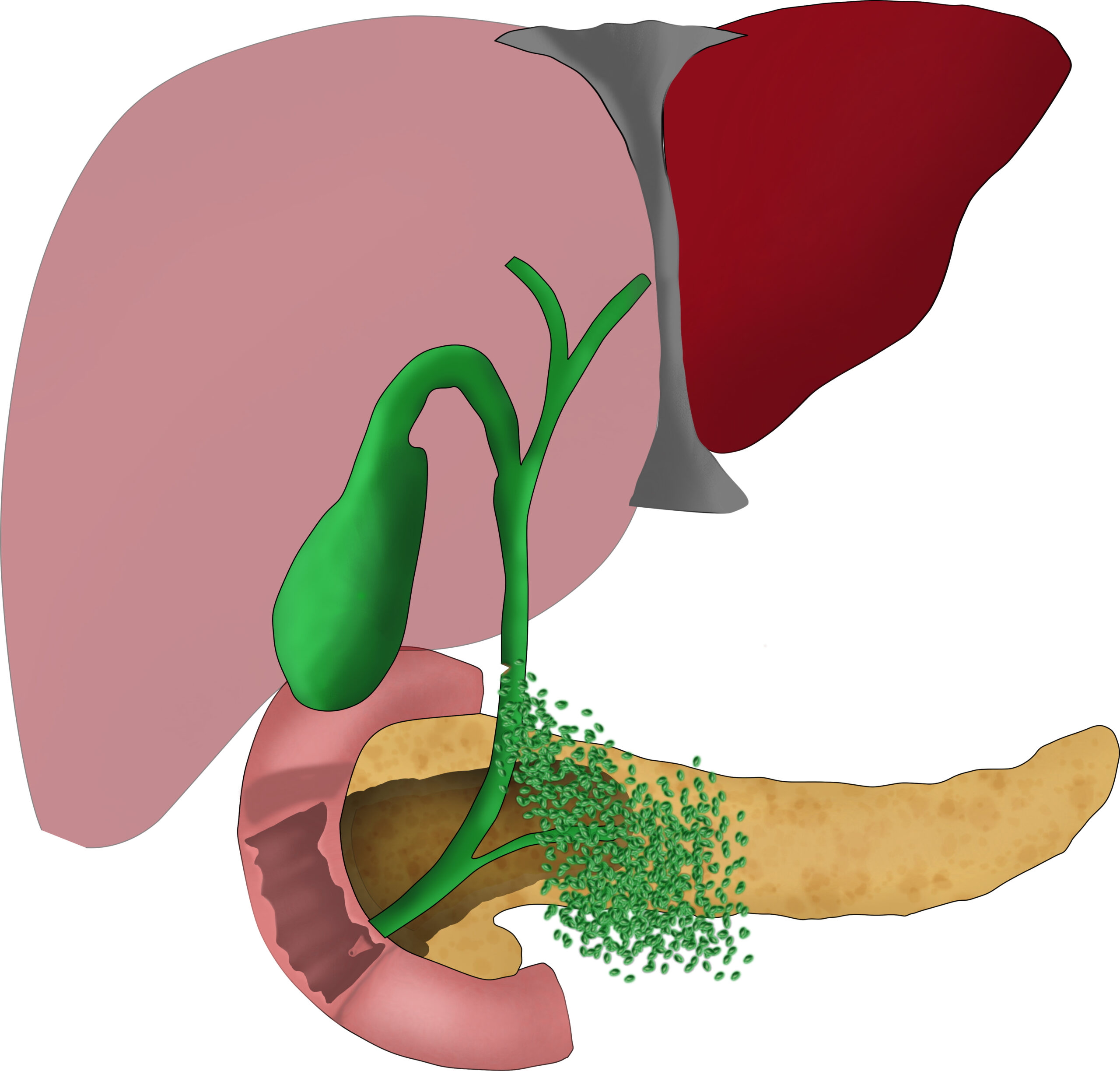 Addressing Gallbladder Concerns with a Specialist