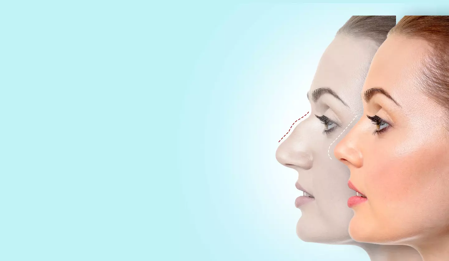 The Recovery Timeline After Cosmetic Plastic Surgery: What To Expect