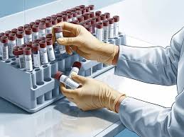 The Role of Imaging in Diagnosing Pancreatic Cancer