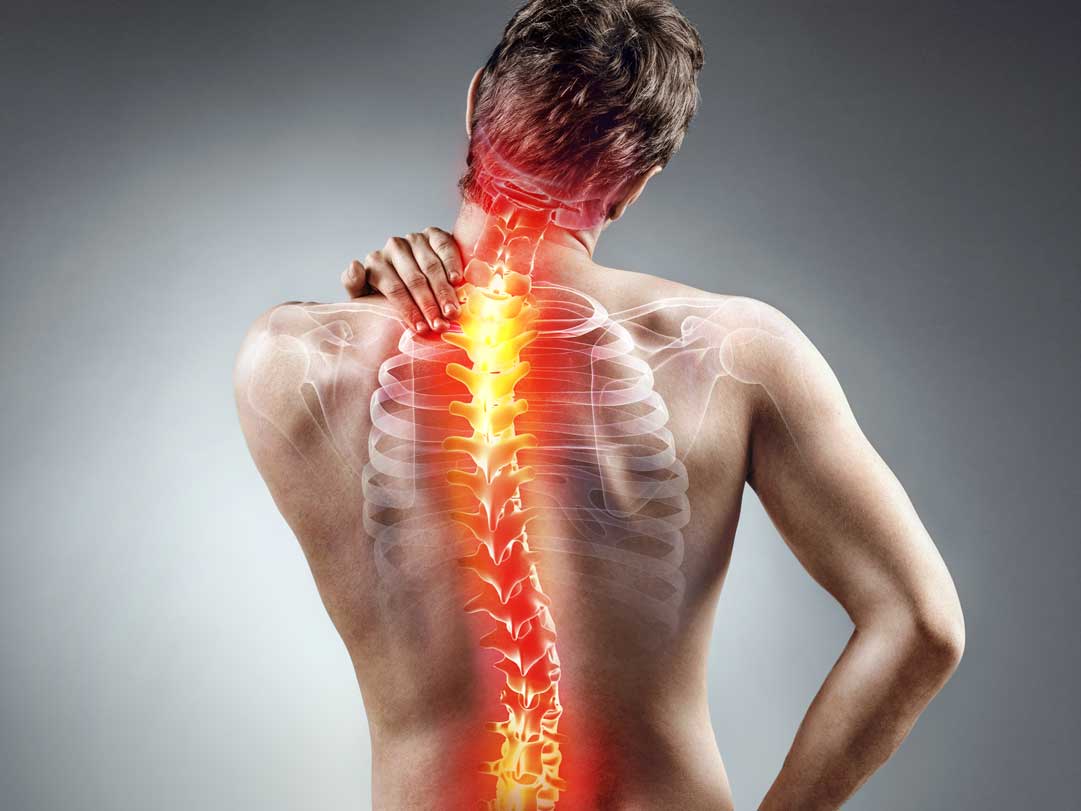The Role of Spine Surgery in Treating Severe Back Conditions