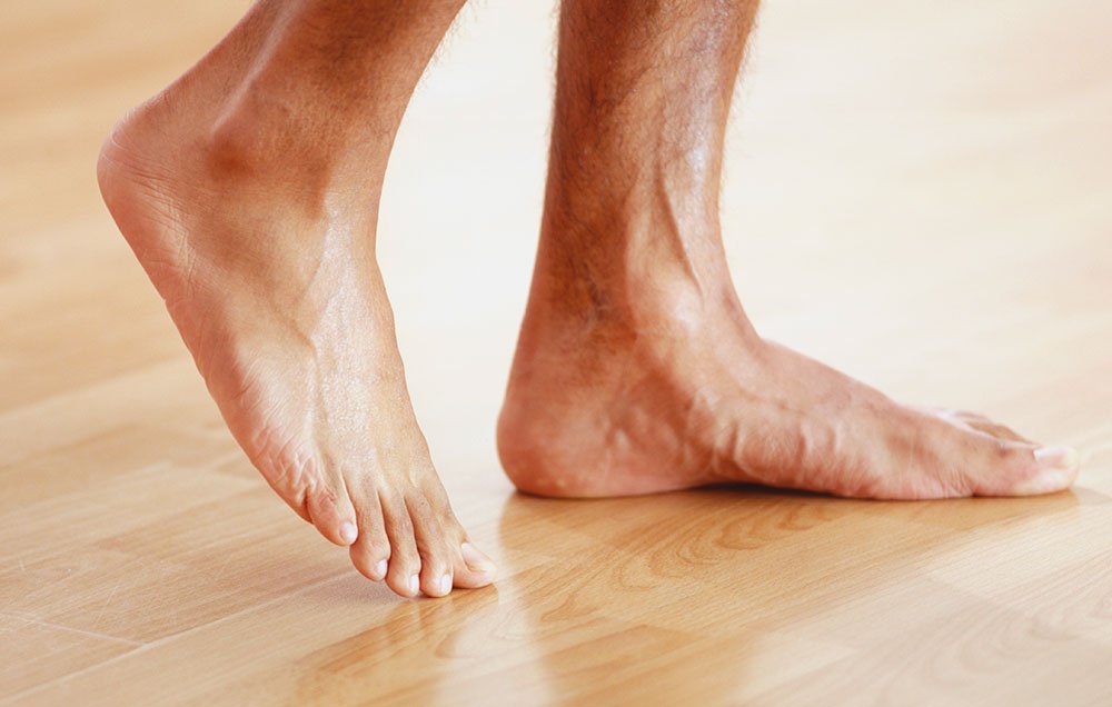 Ways to Treat Flat Feet