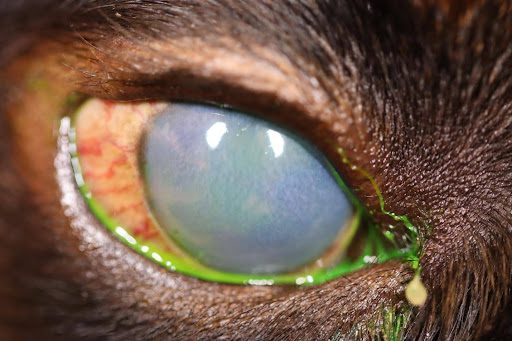 What You Need to Know About Glaucoma Symptoms