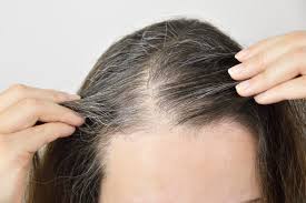 Why Hair Loss Treatment Is More Effective Than Ever
