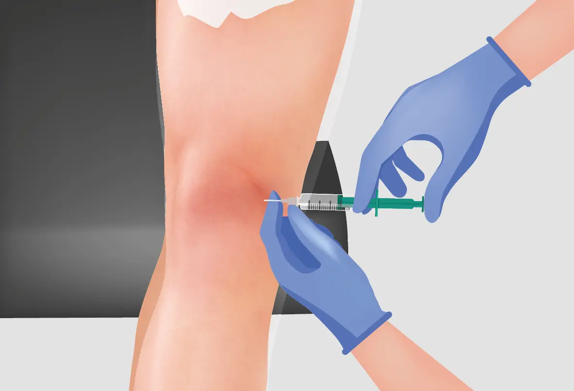 Innovations and Research for Treating Arthritis