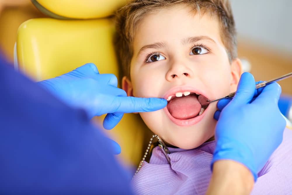 The Benefits of Early Orthodontic Evaluations for Children