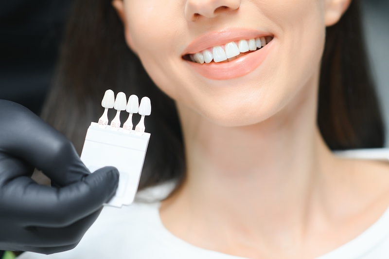 Enhancing Your Smile with Dental Veneers