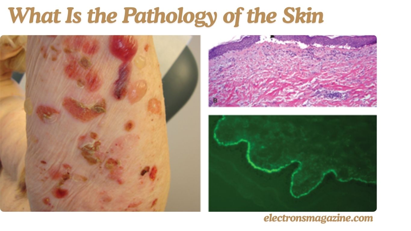 What Is the Pathology of the Skin